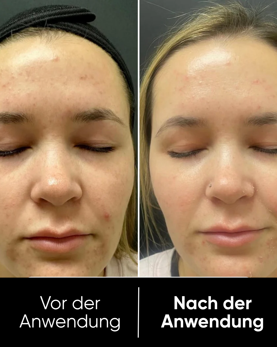 Reis Peel Shot Duo | Weiß & Schwarz Reis