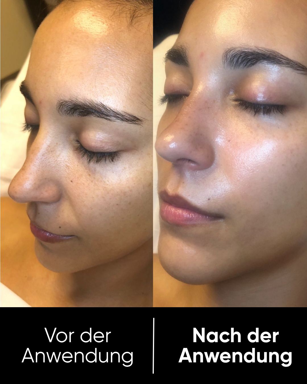 Reis Peel Shot Duo | Weiß & Schwarz Reis