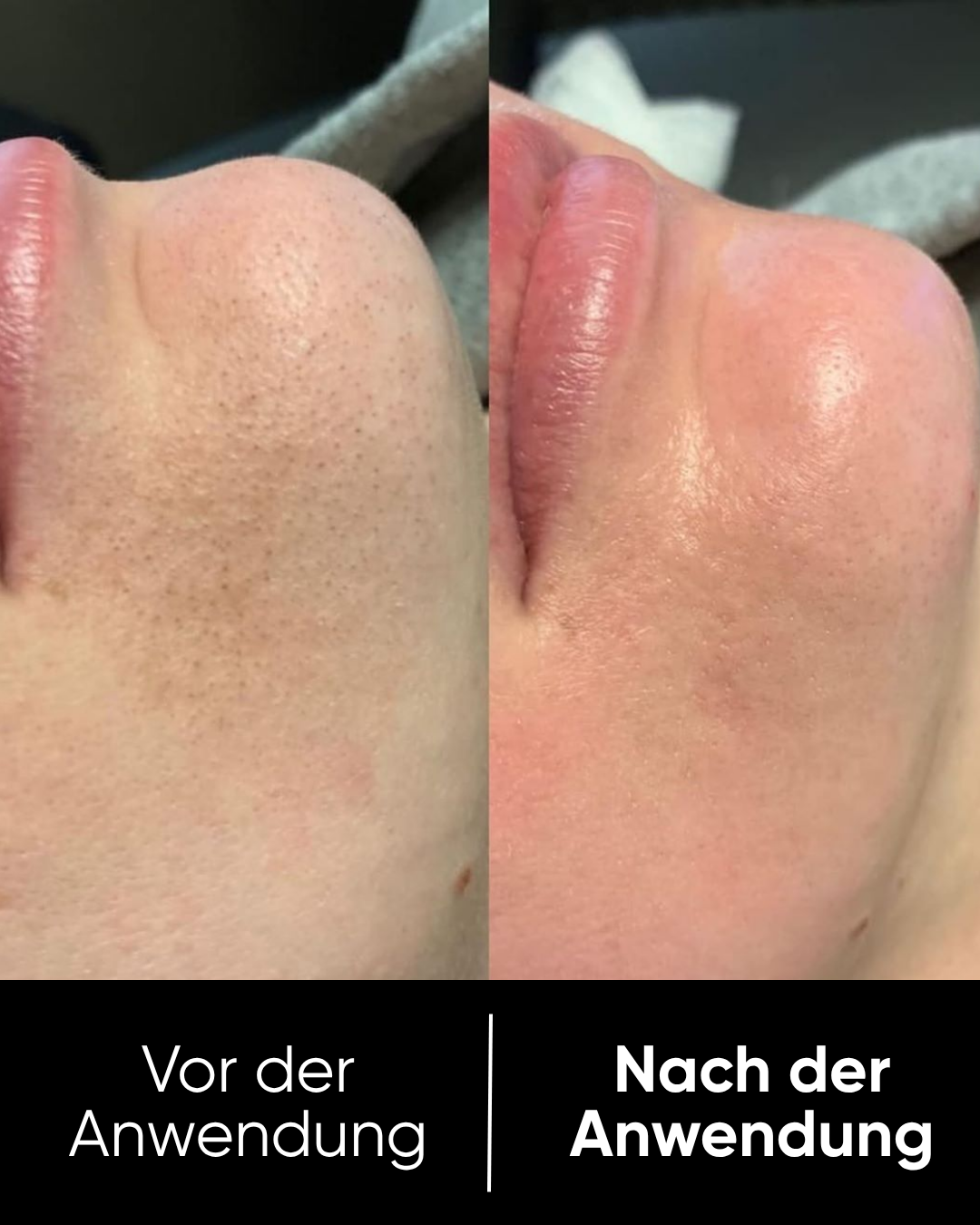 Reis Peel Shot Duo | Weiß & Schwarz Reis