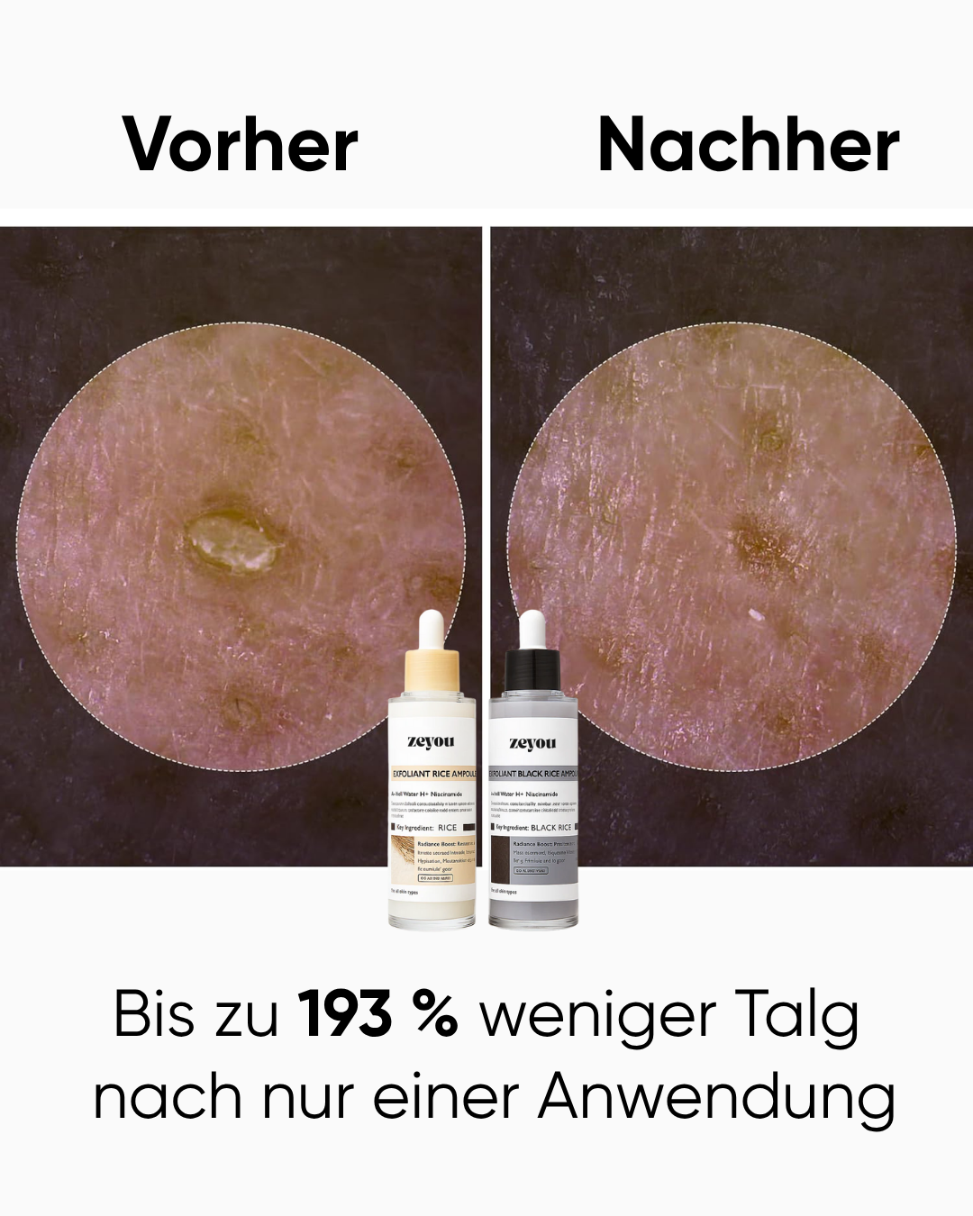 Reis Peel Shot Duo | Weiß & Schwarz Reis
